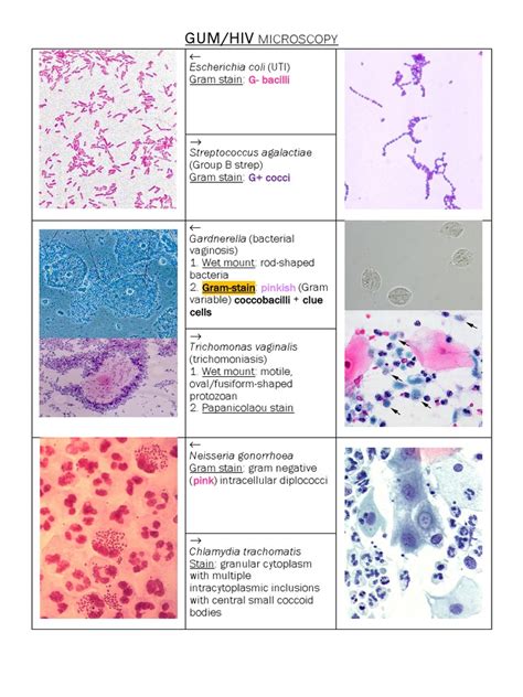 chlamydia gram stain results|Chlamydia trachomatis: Properties, Disease, Lab .